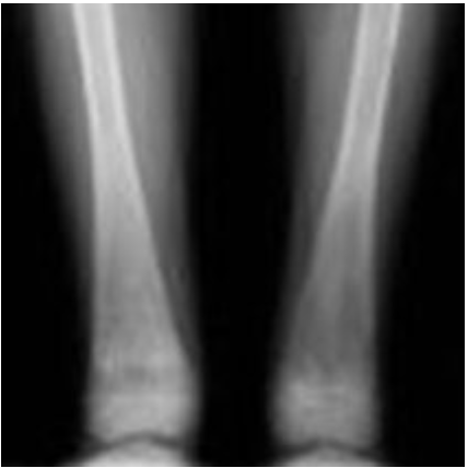 bones